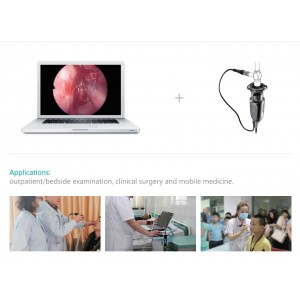 Máy nội soi Tai Mũi Họng Máy nội soi Tai Mũi Họng